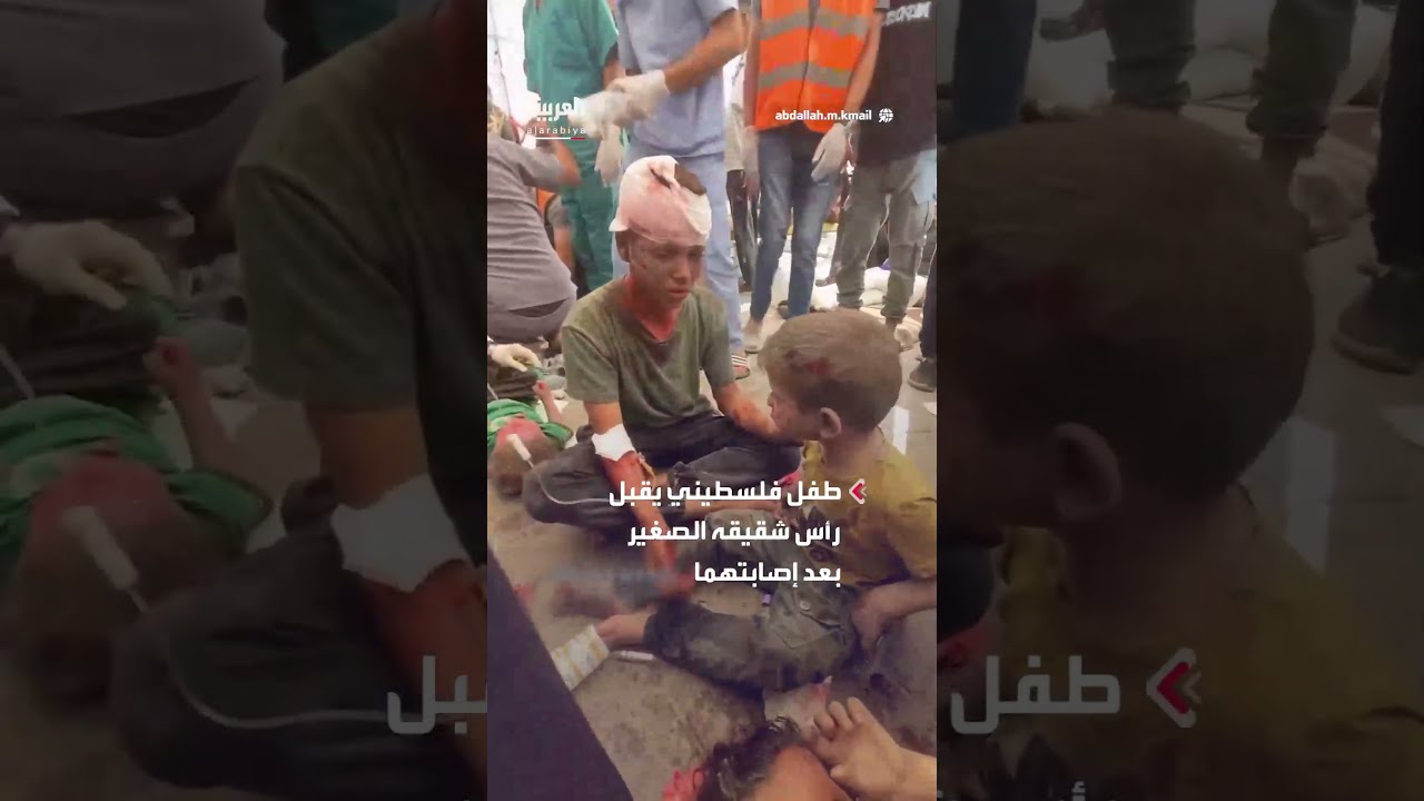 طفل فلسطيني من قطاع غزة يقبل رأس شقيقه الصغير بعد إصابتهما باستهداف إسرائيلي بحي الزيتون