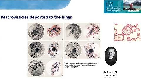 Placental extracellular vesicles, controllers of maternal adaptations to pregnancy by Larry Chamley