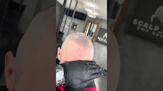 Can you believe this is not real hair? #scalpmicropigmentation