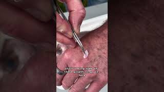 Snapper Dissection and Otolith Extraction - VFA's Dr Corey
