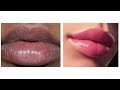 Get JUICY,LUSCIOUS,PLUMP PINK Lips |Natural Remedy|