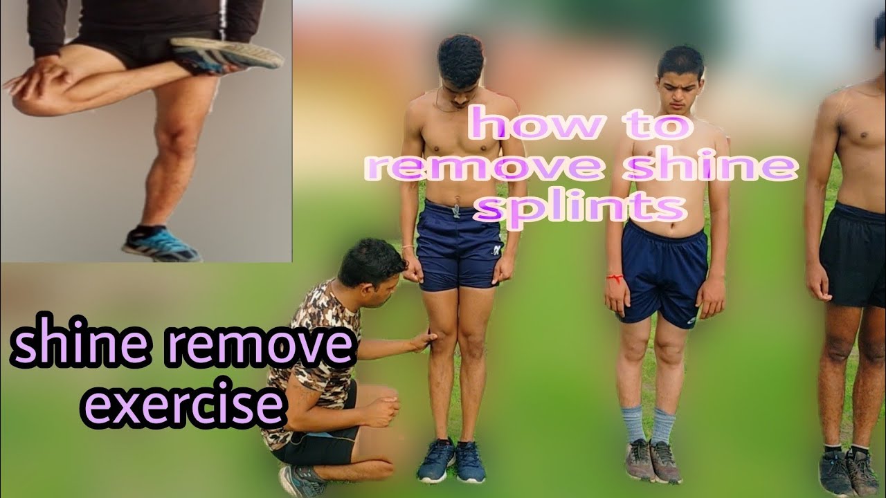 How to remove shine splints? best exercise for shine splints. Sundar