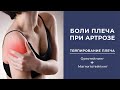 Боль в плече | Артроз плеча | Тейпирование плеча