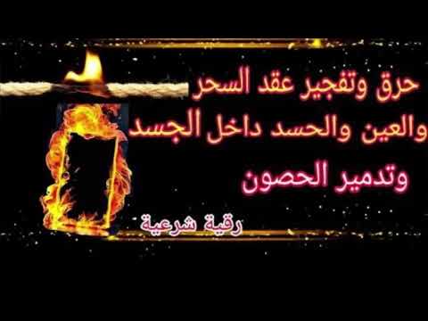 رقية الحرق بآيات الحميم للتوابع وام الصبيان وخدام العين رقية الحرق بآيات الحميم للتوابع وام الصبيان وخدام العين