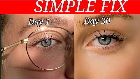 #1 Deficiency Behind POOR EYESIGHT