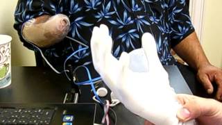 TBP Upper Extremity Prosthetic