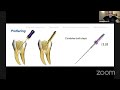 gaining both straighter access and less stress on the apical with F One Kit.