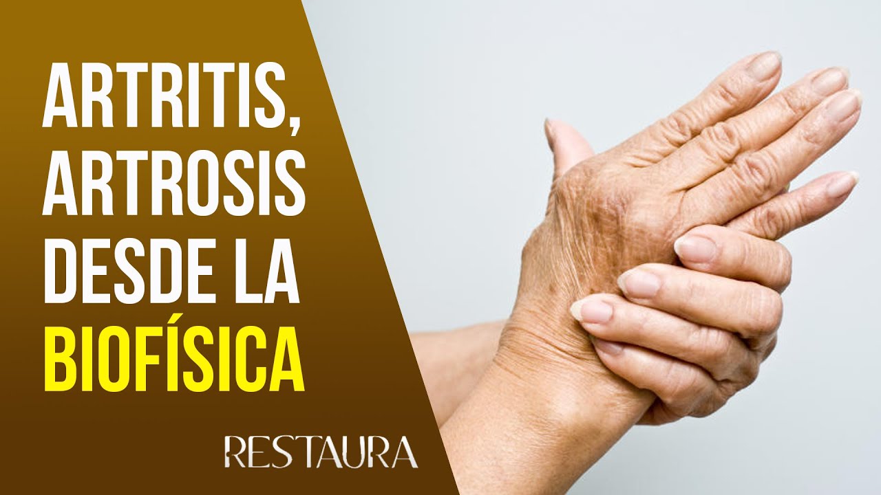 Se puede trabajar con artrosis en las manos