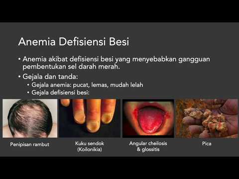 Anemia - Diagnosis, Penyebab Anemia