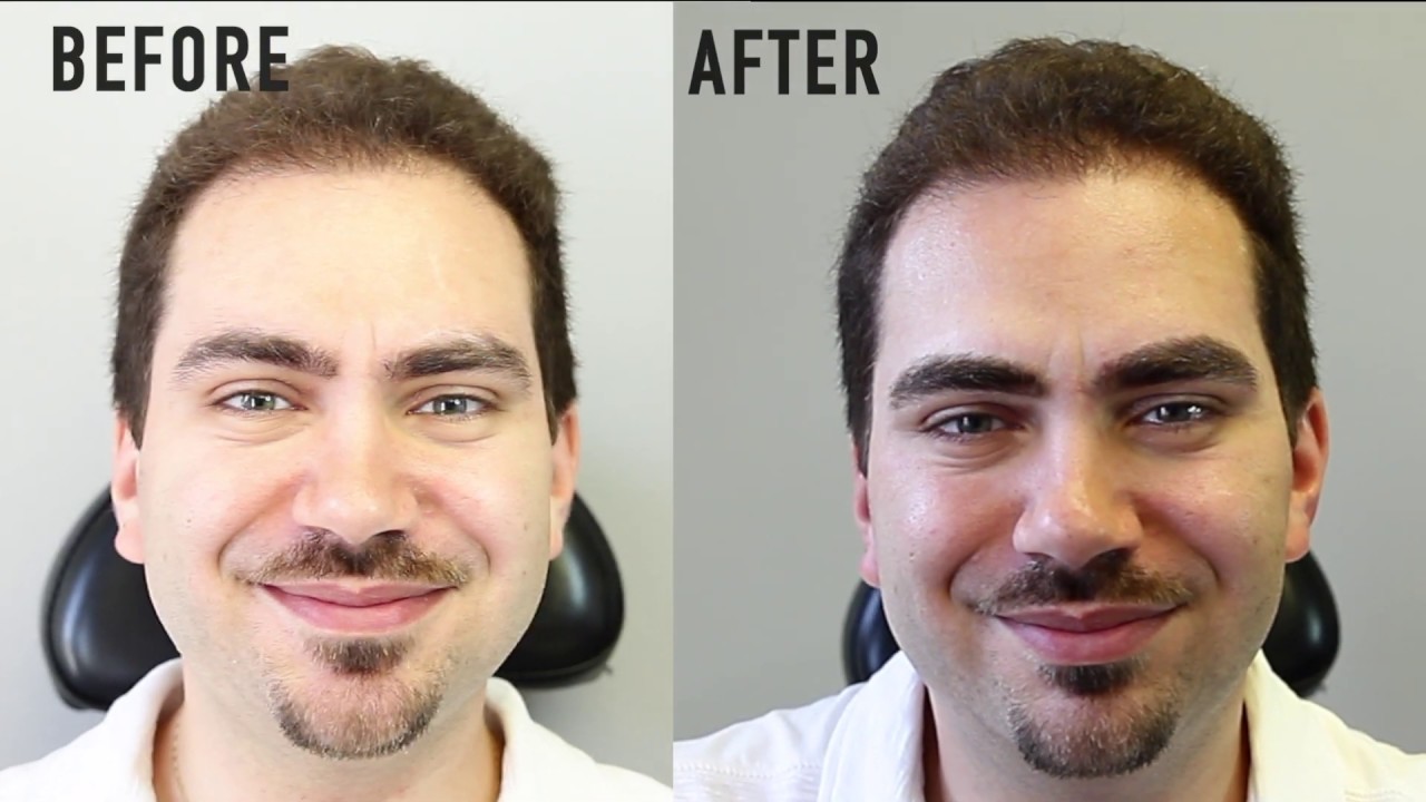 Microblading and Eyebrow Shaping for Men YouTube