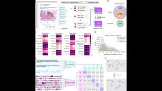 PLIP: A visual–language foundation model for pathology image analysis using medical twitter
