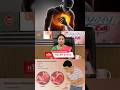 நெஞ்சு குத்தல், வலி காரணம் இதுதான் 😳 | Chest pain, joint pain reasons