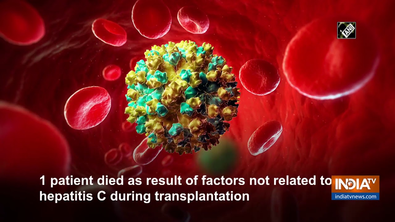 Study finds Hepatitis C-positive livers safe for transplantation, patients cured afterward