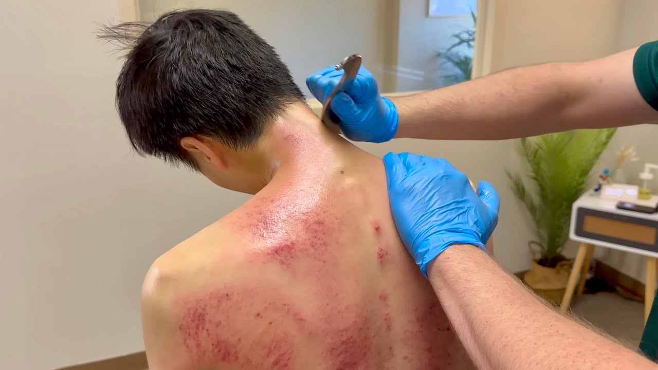 HE HAS THE TRIFECTA😱 MAJOR RED BACK AHEAD