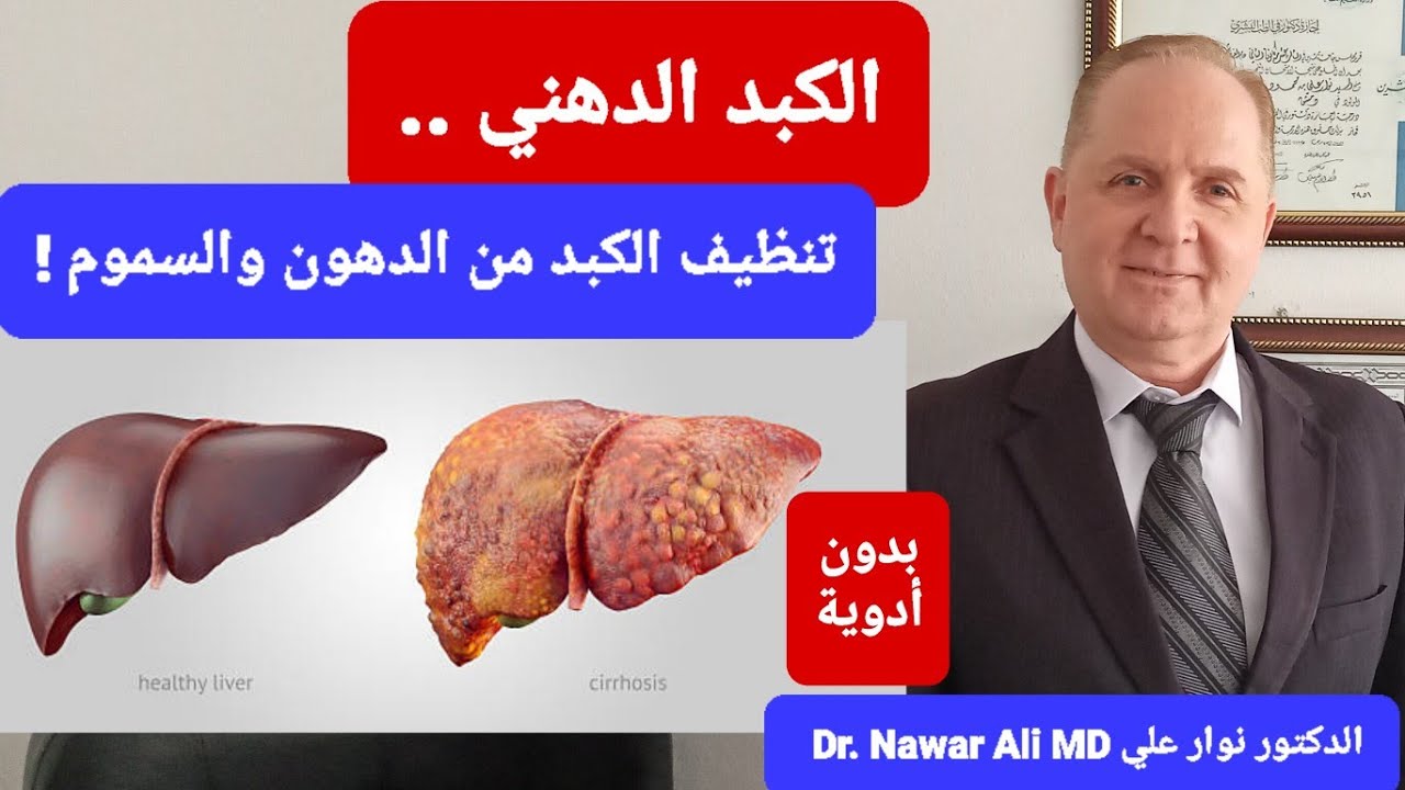 10 أطعمة ومشروبات لتنظيف وتطهير الكبد .. تخلصك من الكبد الدهني والسموم والالتهاب بدون أدوية !