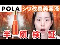 【正直レビュー】ポーラのシワ改善美容液リンクルショットメディカルセラムデュオ１ヶ月検証！