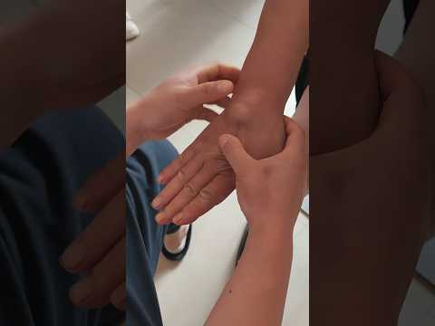 E3309 A Lump That Had Lingered For Years Vanished In Seconds 