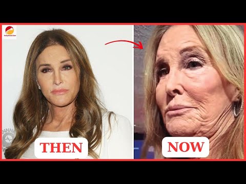 Most UNBELIEVABLE Plastic Surgery of Male Hollywood Celebrities Part 2 | Then and Now 2025