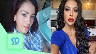 90 Day Fiancé: Jasmine’s Most Shocking Before & After Plastic Surgery Pics