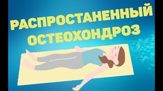 Распространенный остеохондроз | ЛФК упражнения