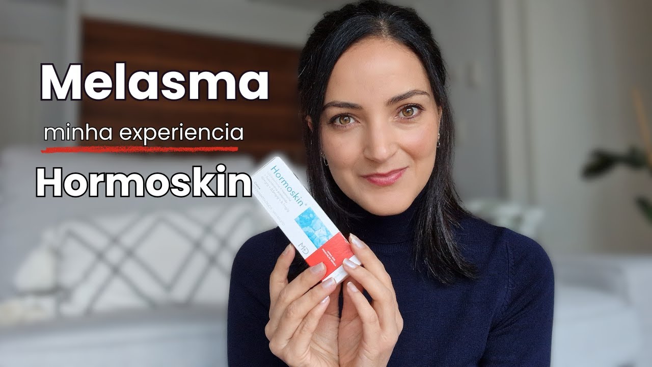 TRATAMENTO do MELASMA: ANTES e DEPOIS do HORMOSKIN (RESULTADOS REAIS ...