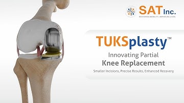 TUKSplasty: Revolutionary Treatment for Osteoarthritis | Shalby Advanced Technologies Inc. (SAT)