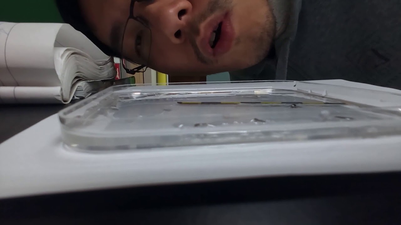 これは危険 おぞましき寄生虫たちの恐怖