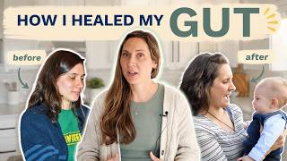 How fixing my GUT HEALTH changed my life | (weight, cystic acne)