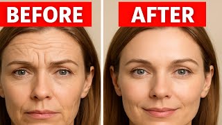 Secret Natural Tricks to Smooth Forehead Wrinkles Fast (No Botox!)