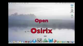 Customizing Osirix Veterinary Annotations or Overlays