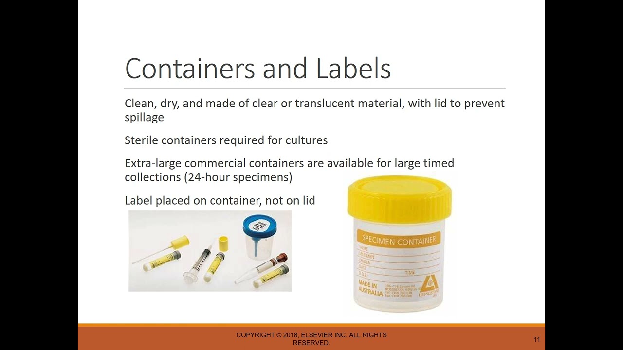 Chapter 2:   Urine Specimen Types