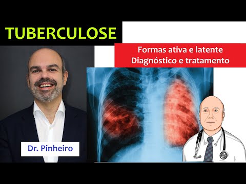 Tudo sobre a tuberculose e suas formas ativa / latente: dos sintomas ao tratamento