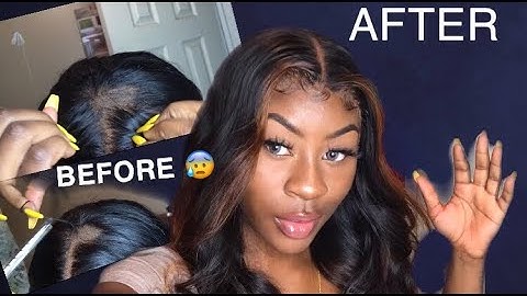 How to FIX a balding frontal/ Closure! (Part 2)