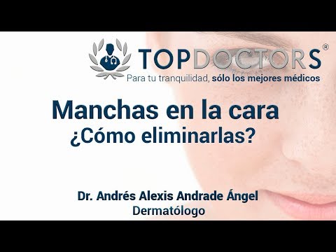 Manchas en la cara ¿Cómo eliminarlas?