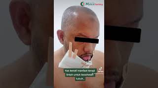 Yuk kenali manfaat terapi lintah untuk kesehatan tubuh....