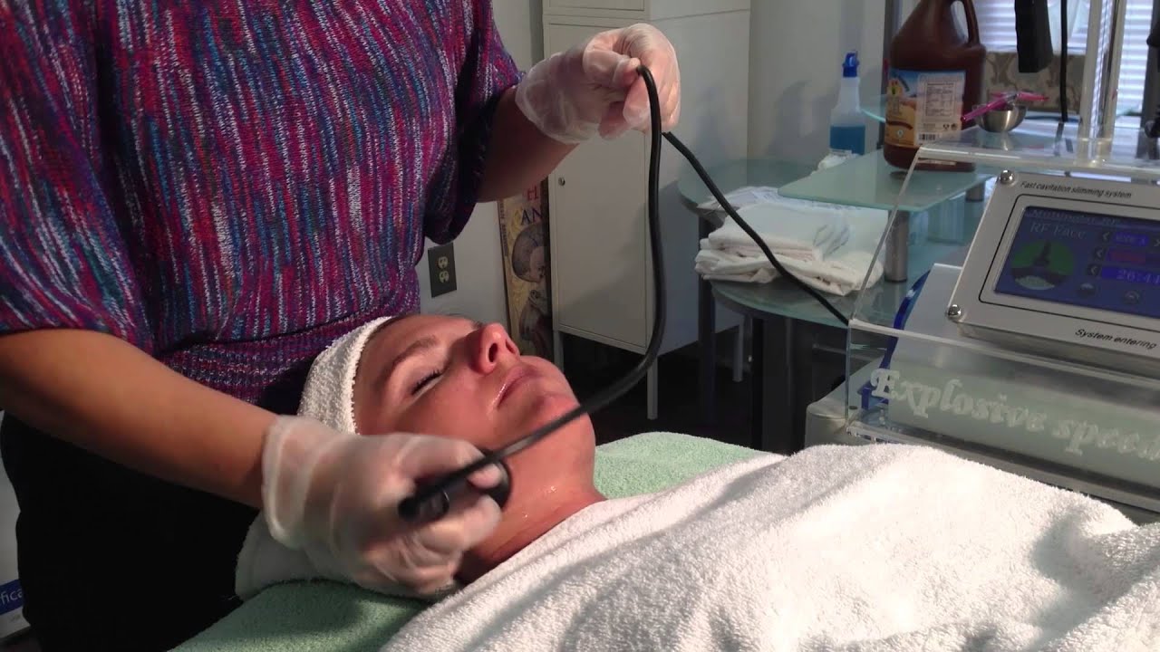 radio frequency ultra lift skin tightening - YouTube