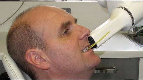 IRMER - Optimisation errors: tube distance. L10