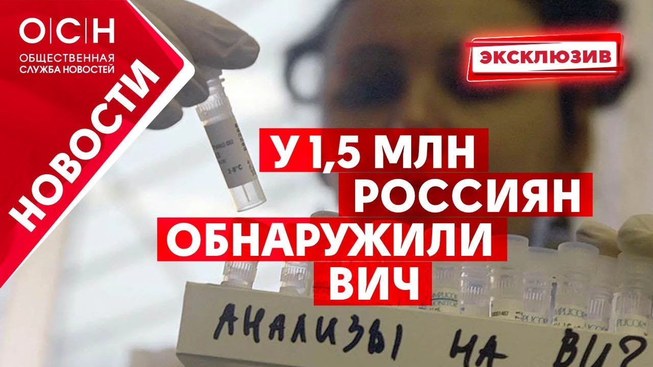 У 1,5 млн россиян обнаружили ВИЧ