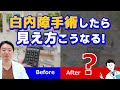 白内障手術術後の見え方を知っておこう！