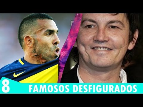 8 FAMOSOS DESFIGURADOS QUE CONOCES