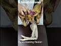 Breech presentation # labour #obgyn #mbbs 
