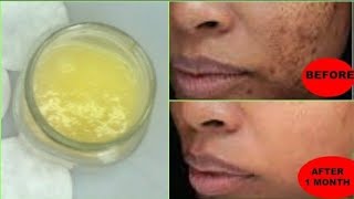 In Just 5 Minutes - Remove Dark Spots, Black Spots, Get Spotless, Fair Even Tone Skin Ll Ngworld