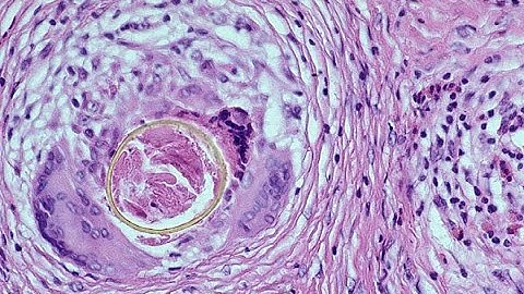 [ GPB ] TH Modun Nội tiết ( OFFLINE )