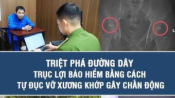 Triệt phá đường dây trục lợi bảo hiểm bằng cách tự đục vỡ xương khớp gây chấn động