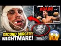 Jake Paul Undergoes SECOND Jaw Surgery👀😱 What Happened?😳 #jakepaul #jawsurgery #anthonyjoshua #viral