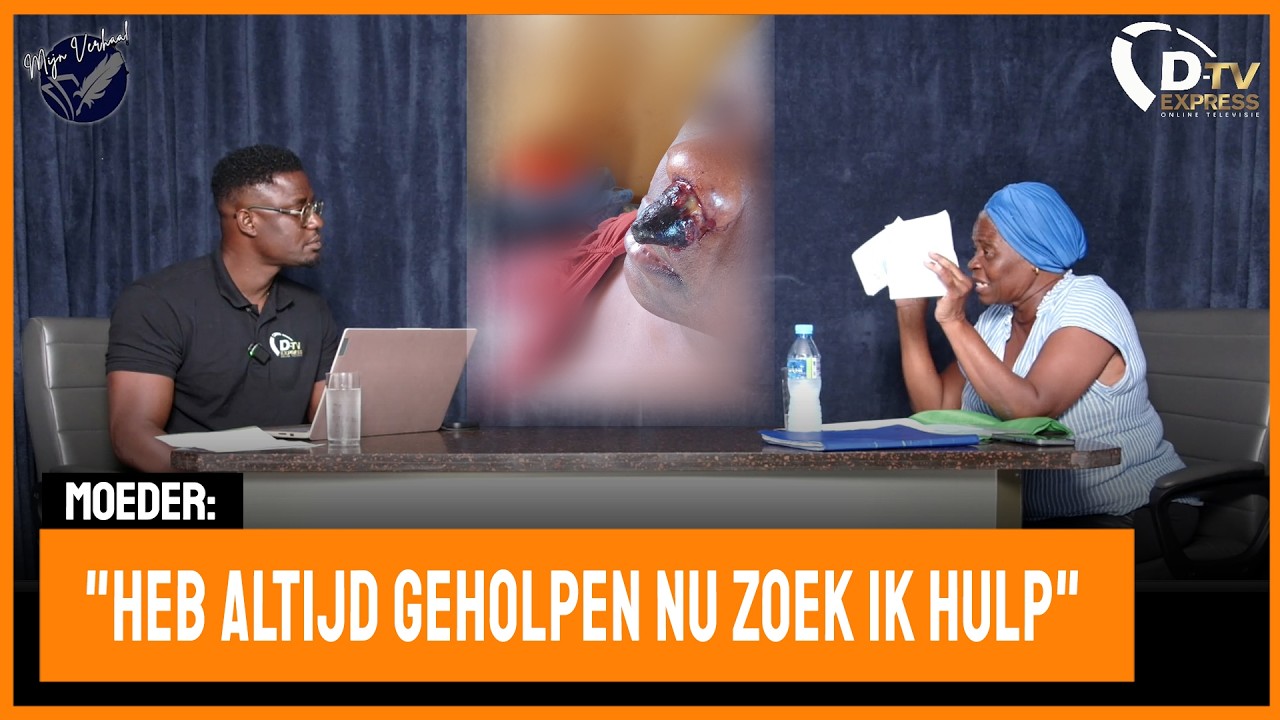 ✍ Mijn verhaal • Moeder zoekt hulp voor verschrikkelijke neuskanker(Suriname)