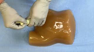 Hernia Reduction Model