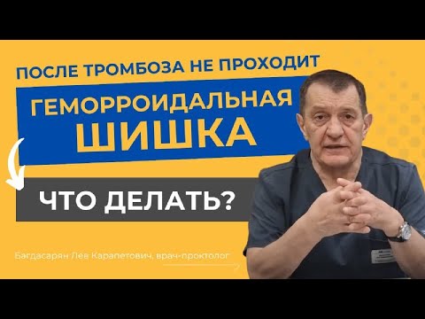 После ТРОМБОЗА не проходит ГЕМОРРОИДАЛЬНАЯ ШИШКА — что делать?