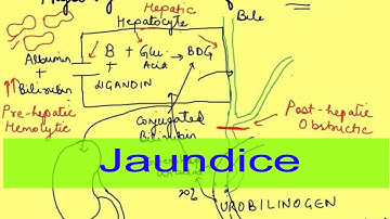 Hemolytische, hepatische en obstructieve geelzucht | Icterus | Gastro-intestinale fysiologie | Pa...
