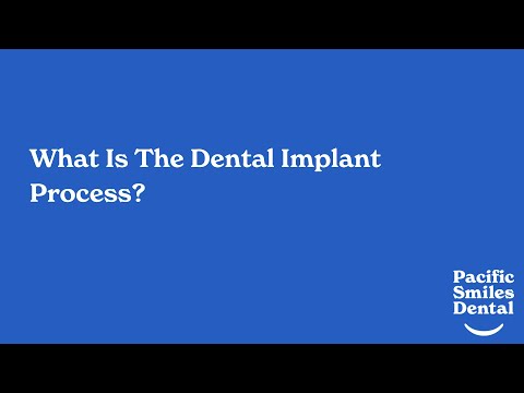Dental Implants Explained: The Ultimate Solution for Missing Teeth - video from Pacific Smiles Dental